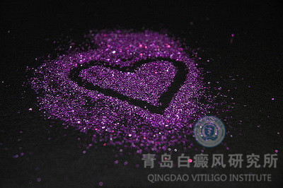 人们患白癜风的原因是什么呢