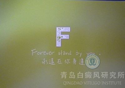 小儿白癜风病因有哪些?