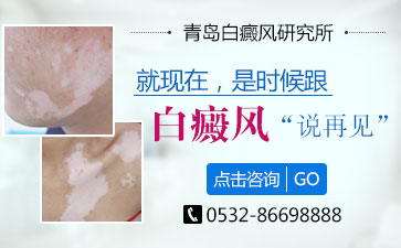 毛庆栋医生解读<a href=http://www.bb106.com/ target=_blank class=infotextkey>白癜风</a>的症状表现