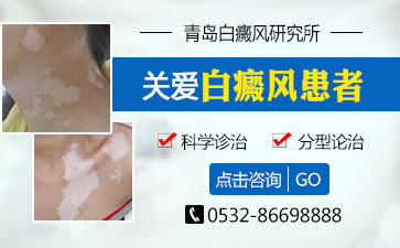 青岛怎么判断白癜风早期的症状