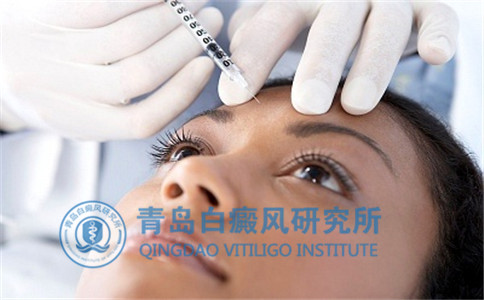 女性白癜风是怎么引起的 女性白癜风是怎么引起的