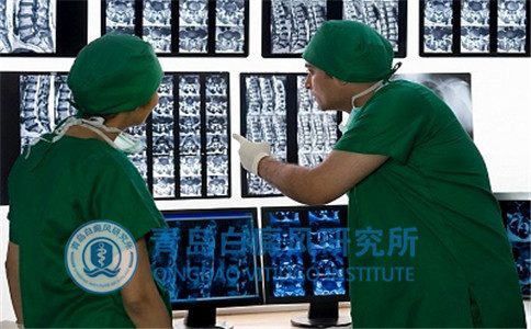 节段性白癜风的危害 节段性白癜风的危害