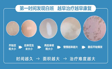 雷鸣医生解读发现白斑但是没有扩散是白癜风吗