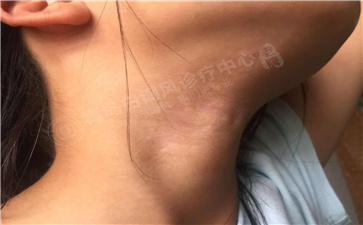 ���������ൺ�ǿ��װ߲�Ч����