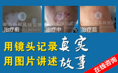 ����Ͱ���Ӧ��������