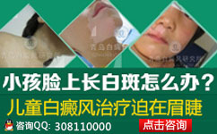 白癜风如果遗传能够提前检查出来吗 白癜风如果遗传能够提前检查出来吗