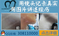 各地白癜风治疗中心 各地白癜风治疗中心