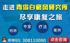 白癜风能治疗吗 白癜风能治疗吗