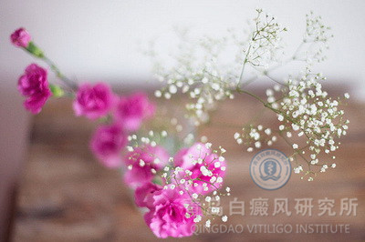 白癜风治疗原则有哪些?